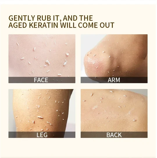 🍊 Tidsbegränsat erbjudande: Köp 1, få 1 gratis! Apelsin peelinggel – tar skonsamt bort döda hudceller ✨
